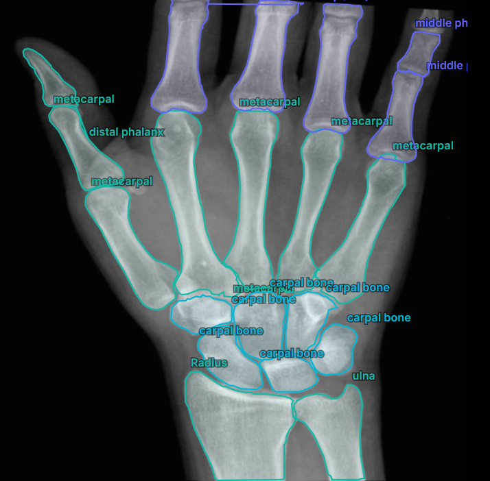 Clinical X-ray annotation for medical AI